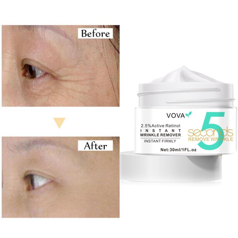 2.5% Active Retinol Eye Cream  – Milk Thistle Silymarin recenzja i cena
